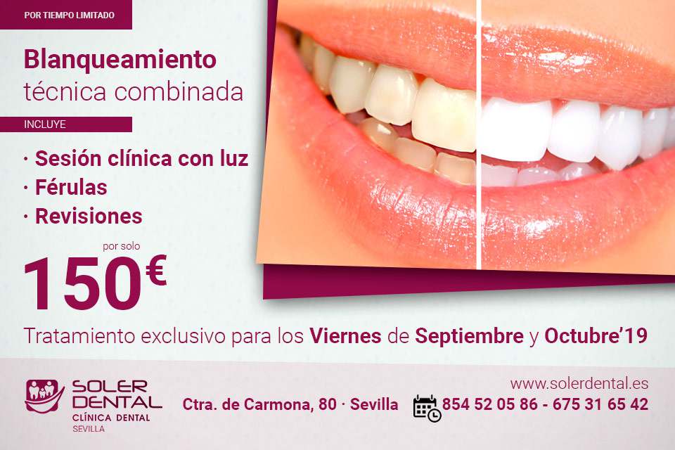 Promocion Blanqueamiento Dental Sevilla