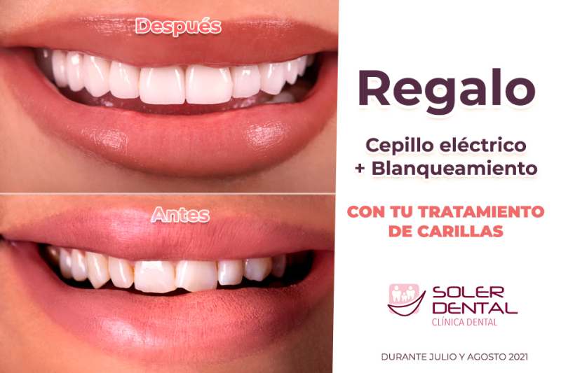 Julio y Agosto, cargado de promociones en Soler Dental